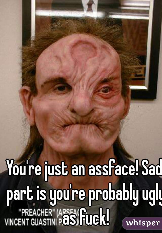 You're just an assface! Sad part is you're probably ugly as fuck!