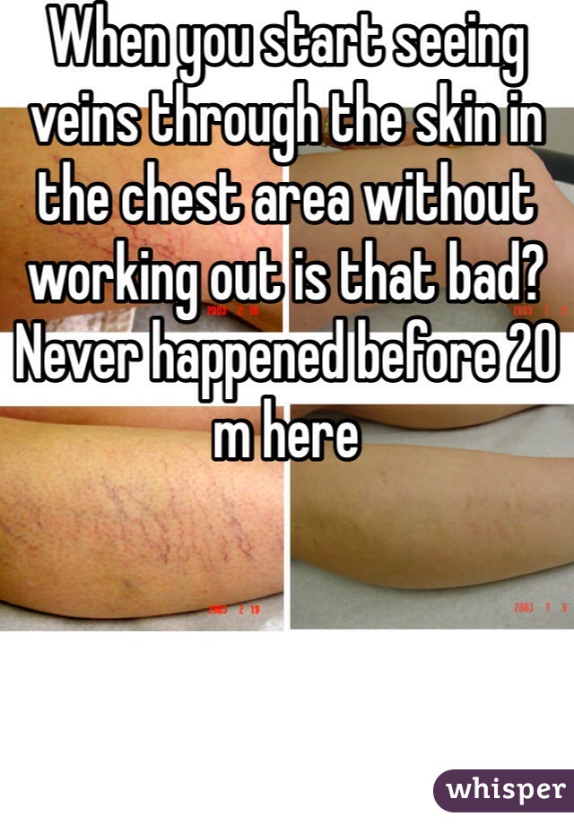 When you start seeing veins through the skin in the chest area without working out is that bad? Never happened before 20 m here