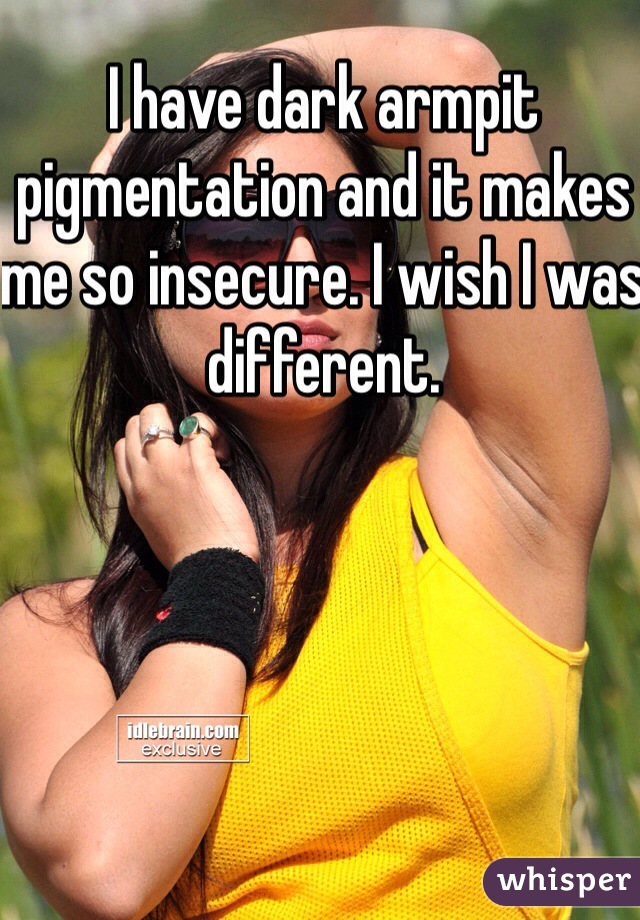 I have dark armpit pigmentation and it makes me so insecure. I wish I was different.