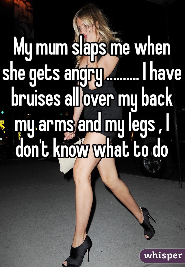 My mum slaps me when she gets angry .......... I have bruises all over my back my arms and my legs , I don't know what to do 
