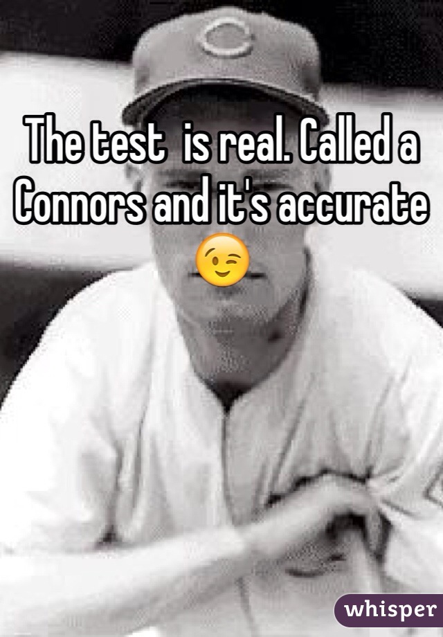 The test  is real. Called a Connors and it's accurate 😉