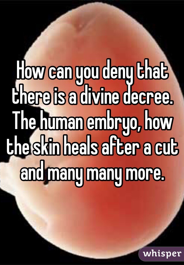 How can you deny that there is a divine decree. The human embryo, how the skin heals after a cut and many many more. 