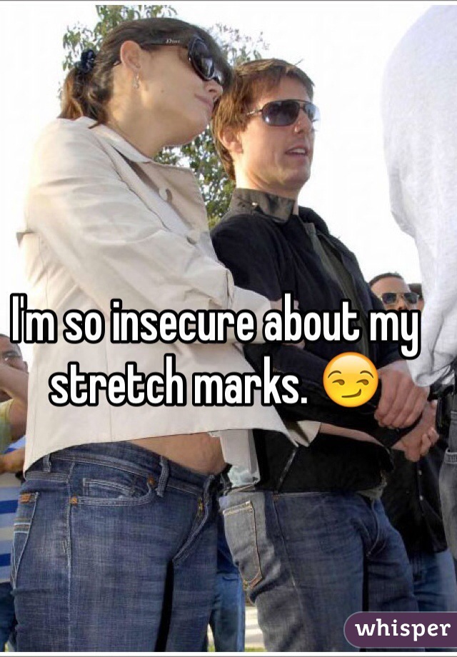 I'm so insecure about my stretch marks. 😏