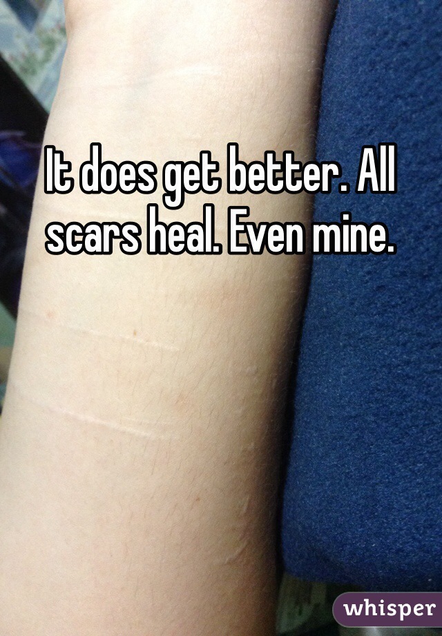 It does get better. All scars heal. Even mine. 