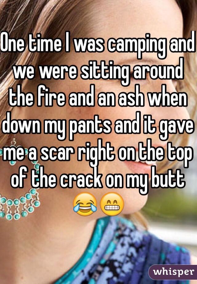 One time I was camping and we were sitting around the fire and an ash when down my pants and it gave me a scar right on the top of the crack on my butt😂😁
