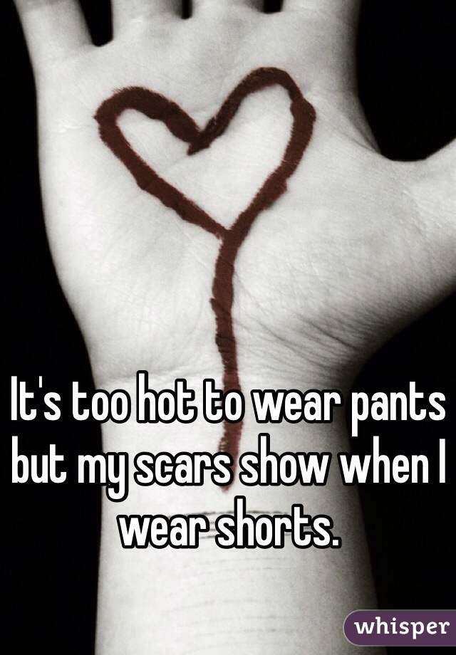 It's too hot to wear pants but my scars show when I wear shorts.