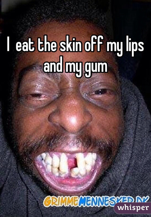 I  eat the skin off my lips and my gum 