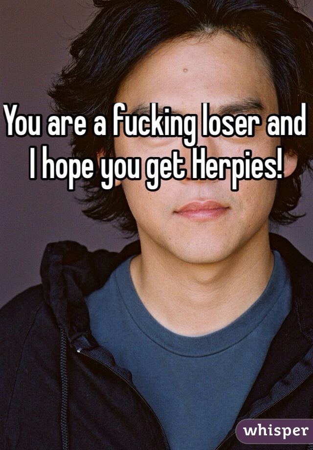 You are a fucking loser and I hope you get Herpies!