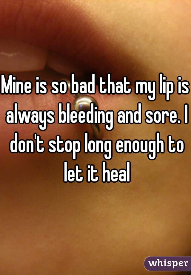 Mine is so bad that my lip is always bleeding and sore. I don't stop long enough to let it heal