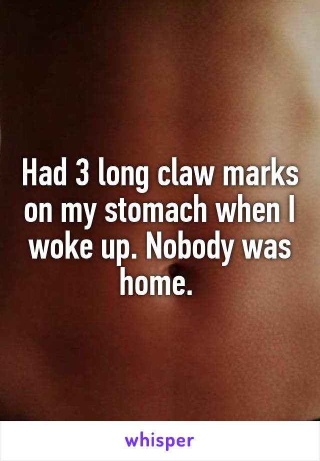 Had 3 long claw marks on my stomach when I woke up. Nobody was home. 