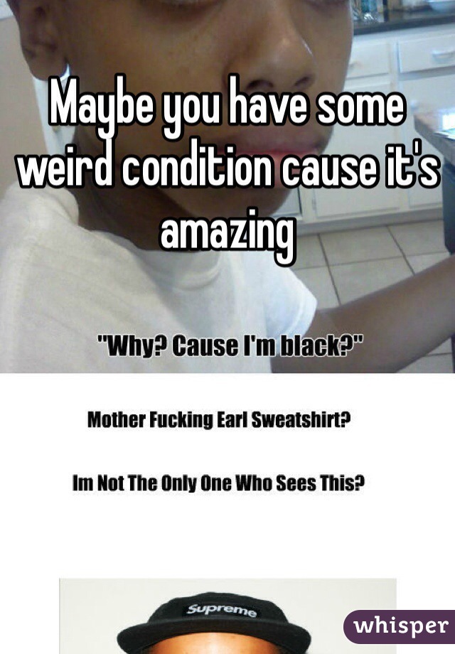 Maybe you have some weird condition cause it's amazing
