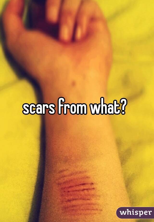scars from what? 
