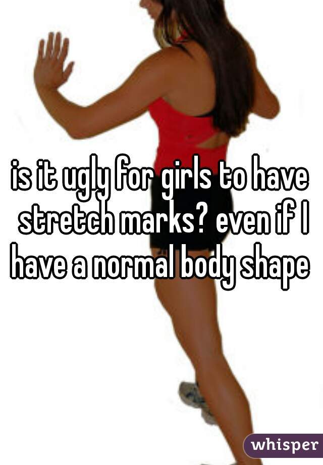 is it ugly for girls to have stretch marks? even if I have a normal body shape 