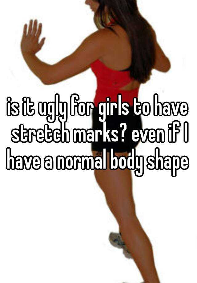 is it ugly for girls to have stretch marks? even if I have a normal body shape 