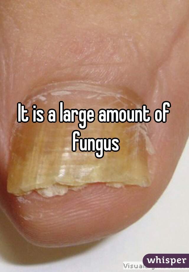 It is a large amount of fungus