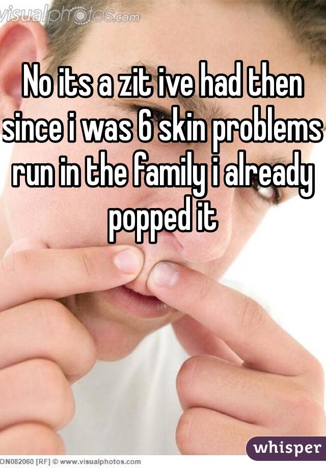 No its a zit ive had then since i was 6 skin problems run in the family i already popped it