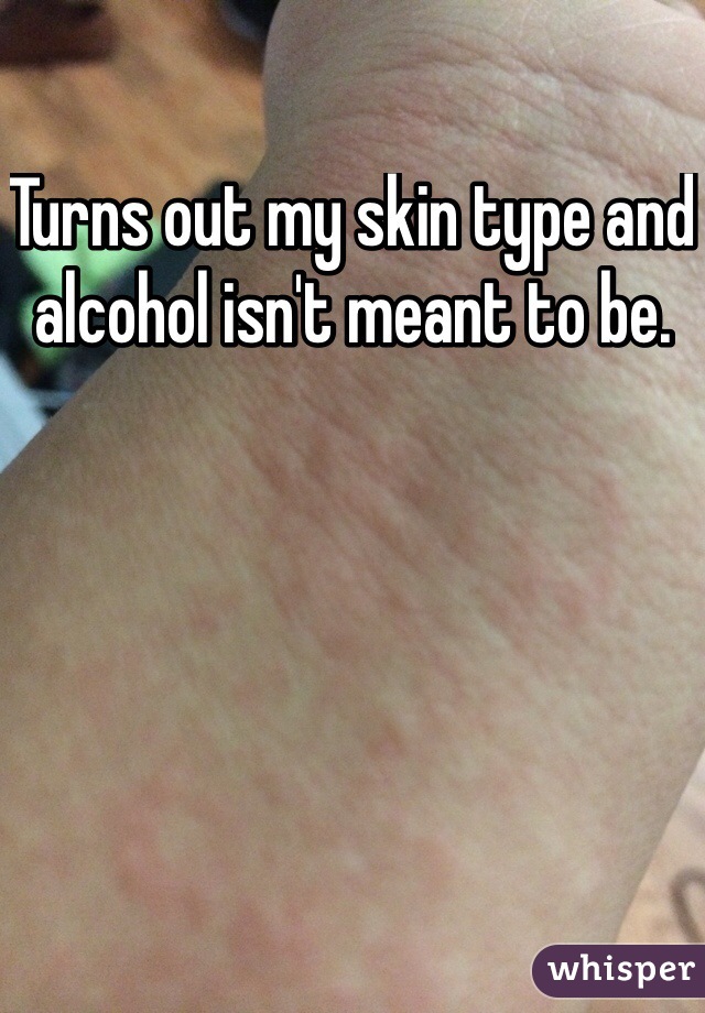 Turns out my skin type and alcohol isn't meant to be. 