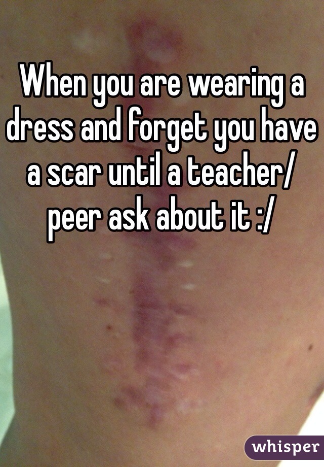 When you are wearing a dress and forget you have a scar until a teacher/peer ask about it :/