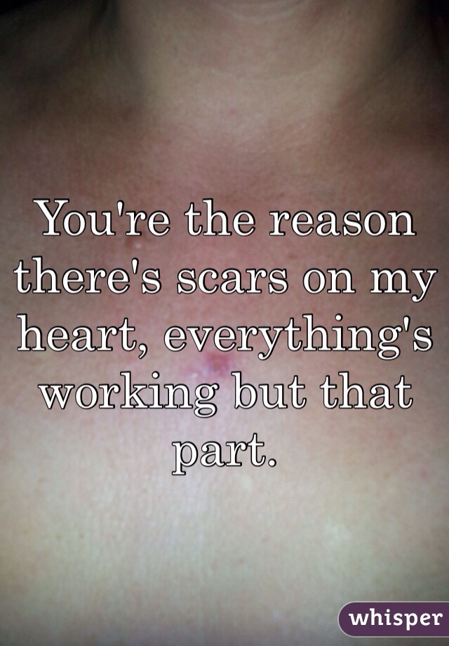 You're the reason there's scars on my heart, everything's working but that part. 