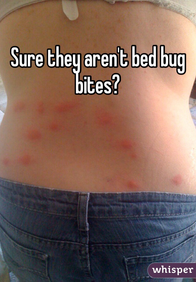 Sure they aren't bed bug bites?