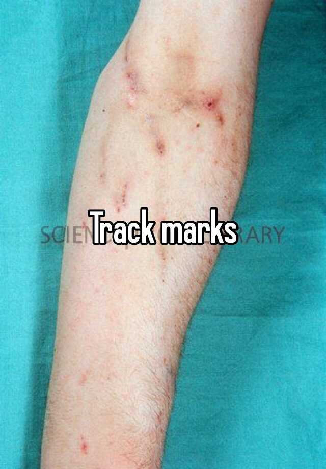 track-marks