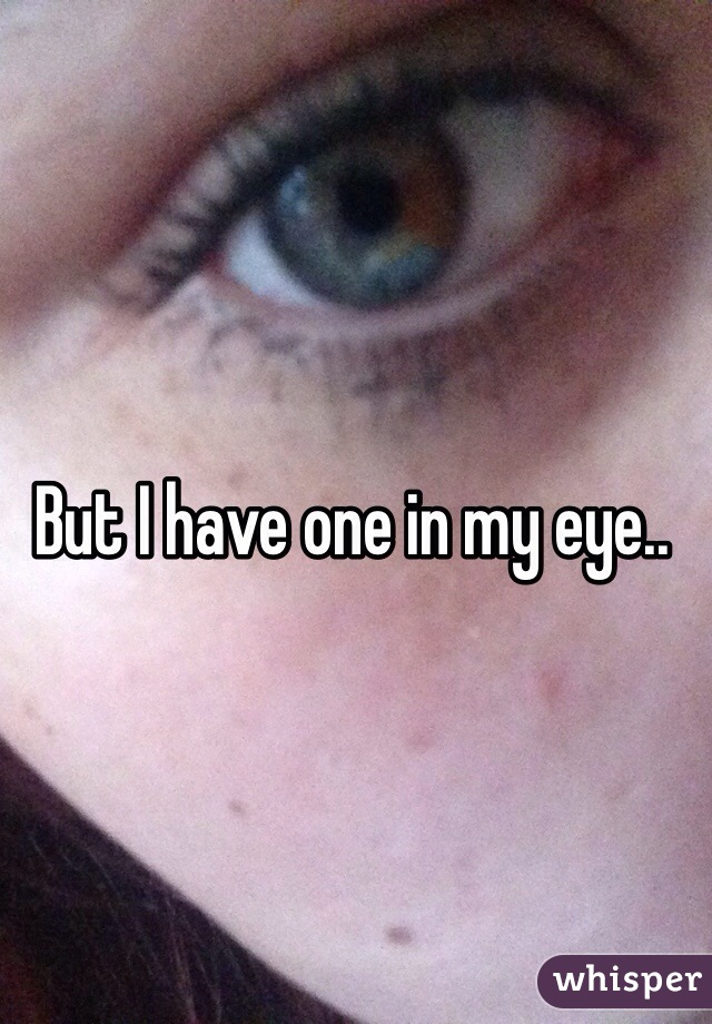 But I have one in my eye..