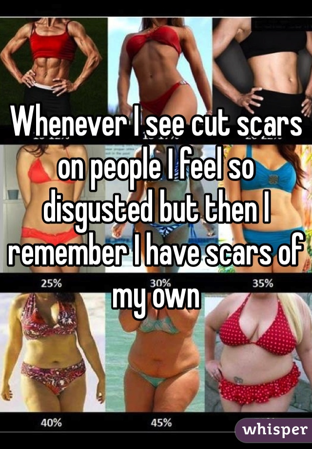 Whenever I see cut scars on people I feel so disgusted but then I remember I have scars of my own
