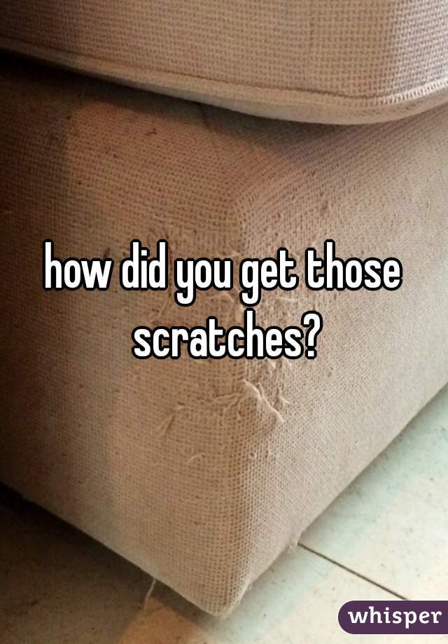how did you get those scratches?
