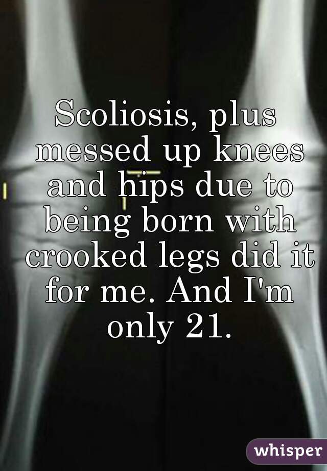 Scoliosis, plus messed up knees and hips due to being born with crooked legs did it for me. And I'm only 21.