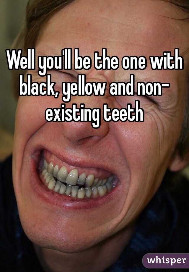 Well you'll be the one with black, yellow and non-existing teeth 
