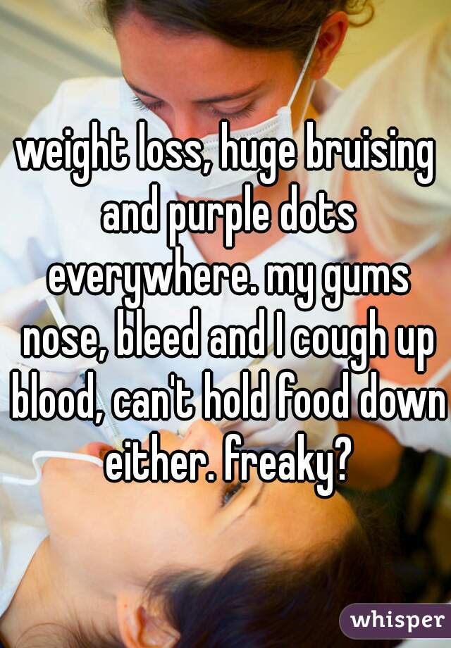 weight loss, huge bruising and purple dots everywhere. my gums nose, bleed and I cough up blood, can't hold food down either. freaky?