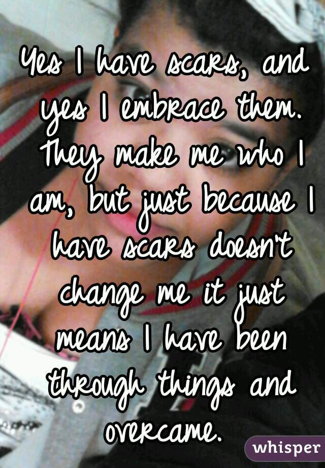Yes I have scars, and yes I embrace them. They make me who I am, but just because I have scars doesn't change me it just means I have been through things and overcame. 