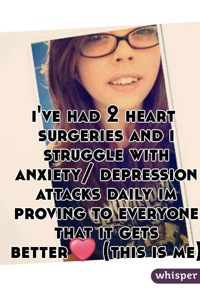 i've had 2 heart surgeries and i struggle with anxiety/ depression attacks daily im proving to everyone that it gets better❤ (this is me)  