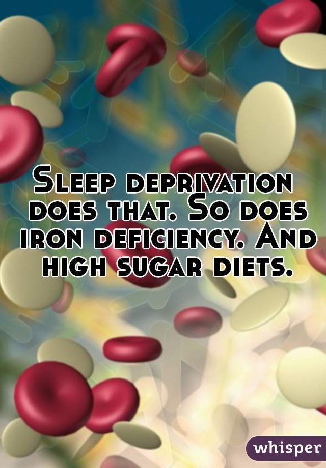 Sleep deprivation does that. So does iron deficiency. And high sugar diets.