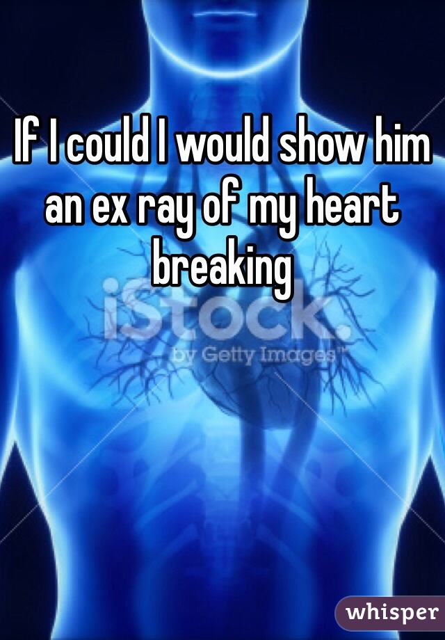 If I could I would show him an ex ray of my heart breaking 
