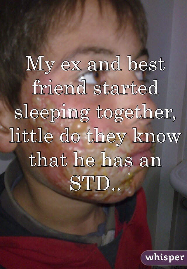 My ex and best friend started sleeping together, little do they know that he has an STD..
