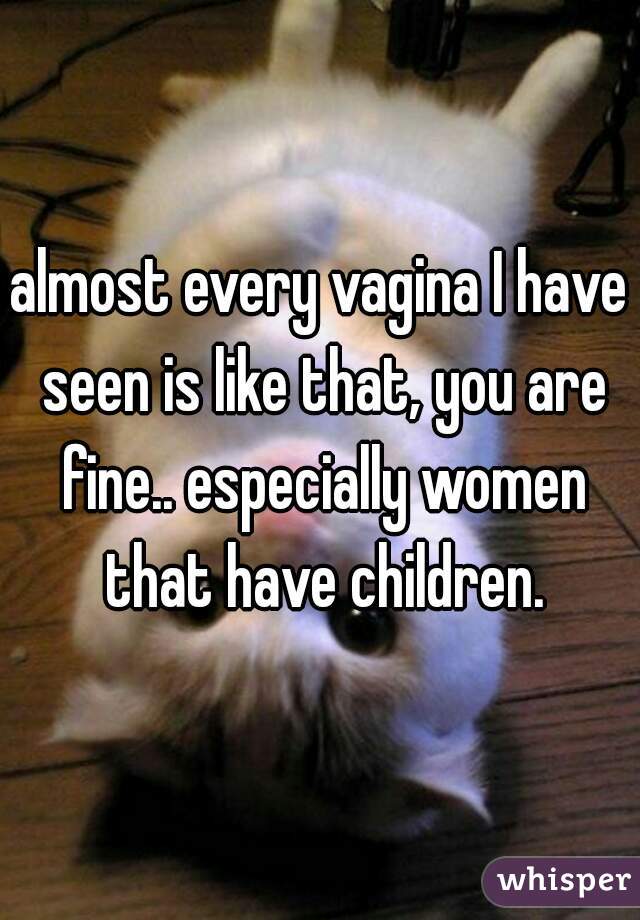 almost every vagina I have seen is like that, you are fine.. especially women that have children.
