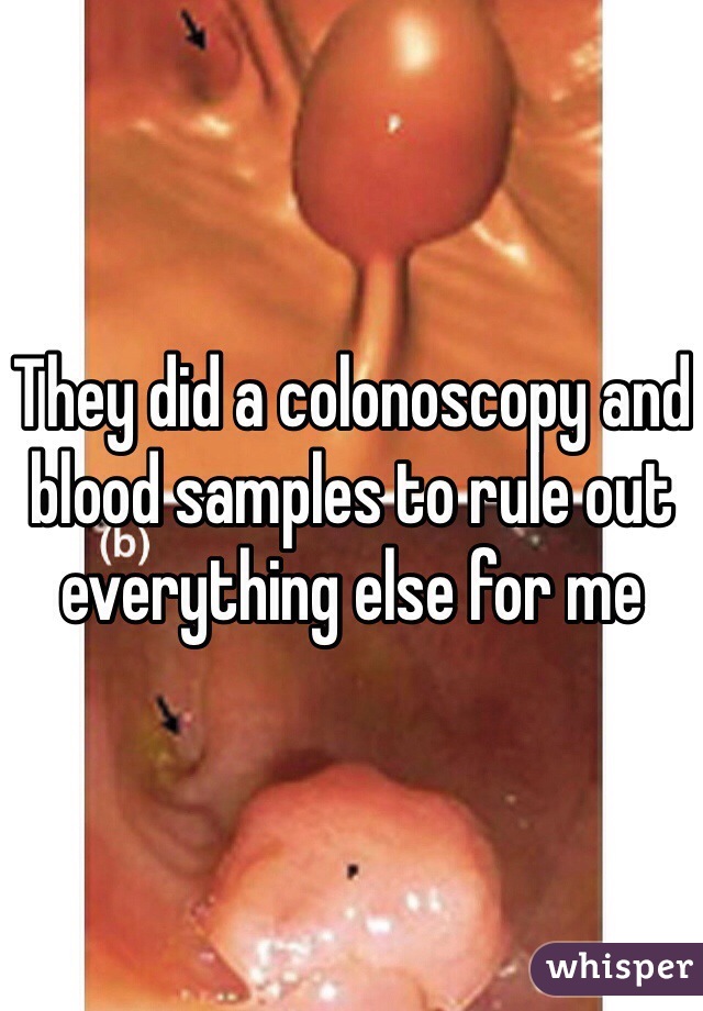 They did a colonoscopy and blood samples to rule out everything else for me 