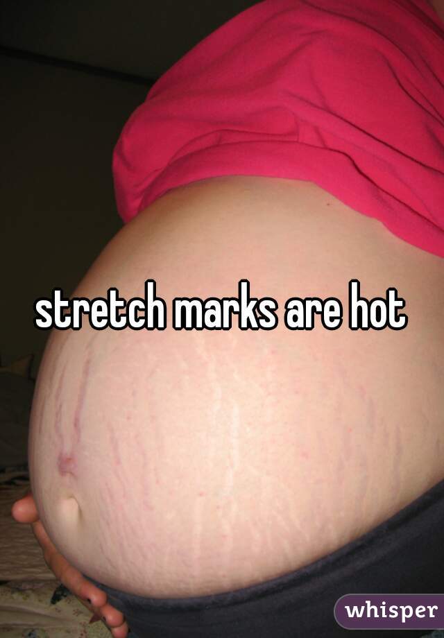 stretch marks are hot