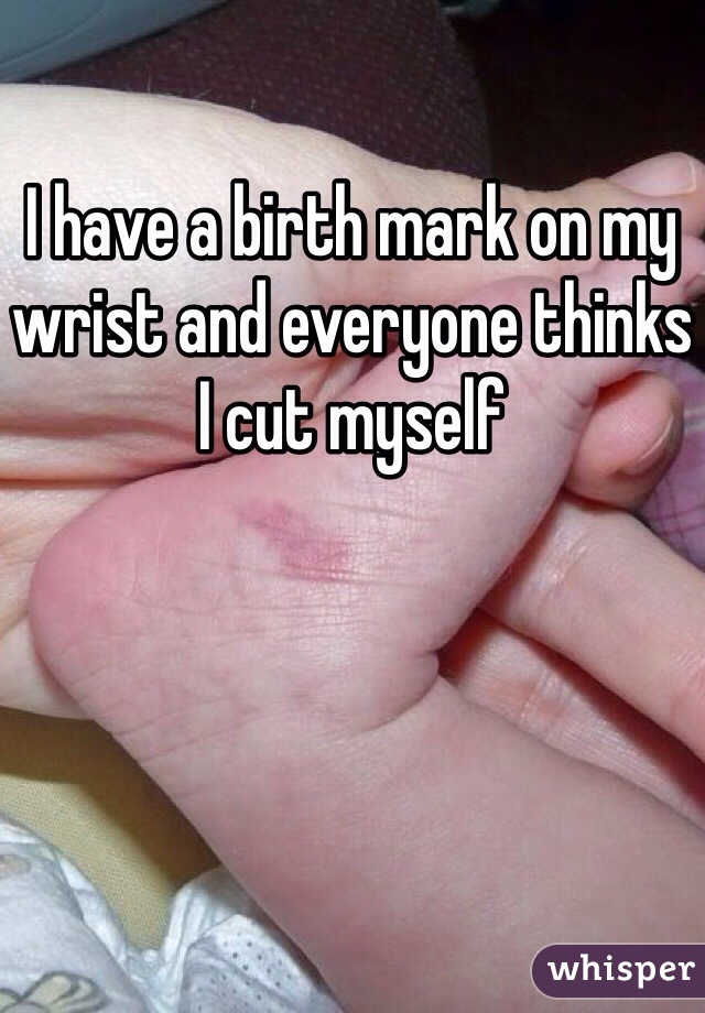 I have a birth mark on my wrist and everyone thinks I cut myself