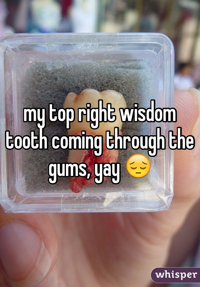 my top right wisdom tooth coming through the gums, yay 😔