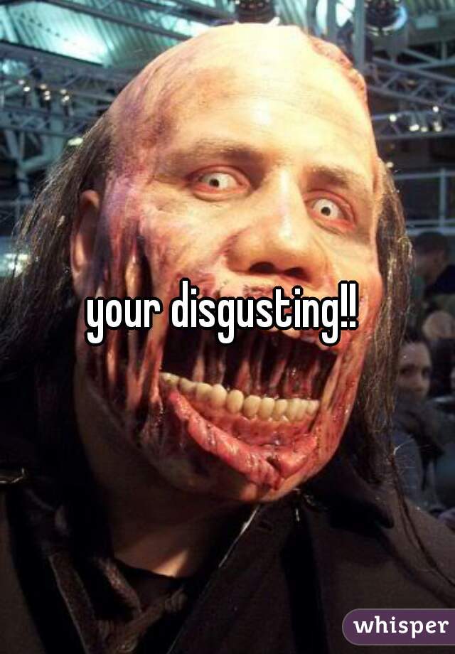 your disgusting!! 