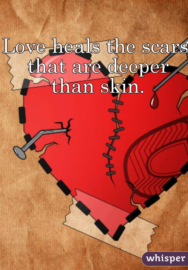 Love heals the scars that are deeper than skin.