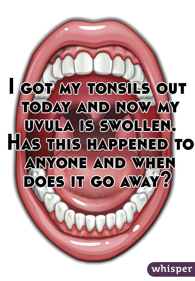 I got my tonsils out today and now my uvula is swollen. Has this happened to anyone and when does it go away? 
