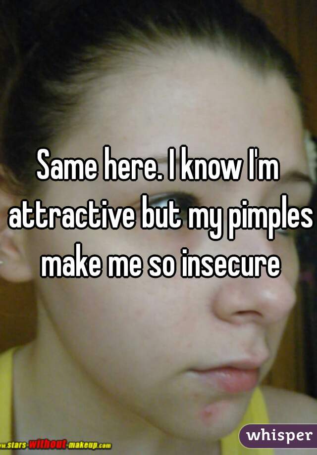 Same here. I know I'm attractive but my pimples make me so insecure