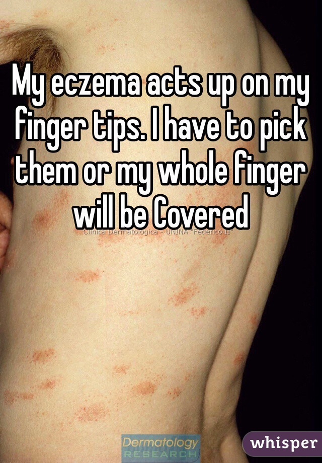 My eczema acts up on my finger tips. I have to pick them or my whole finger will be Covered  
