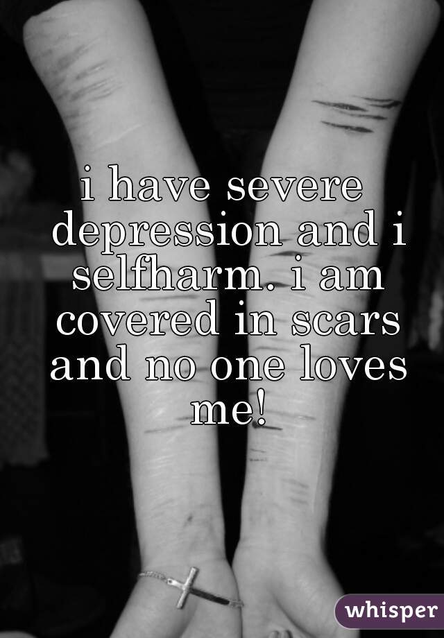 i have severe depression and i selfharm. i am covered in scars and no one loves me!