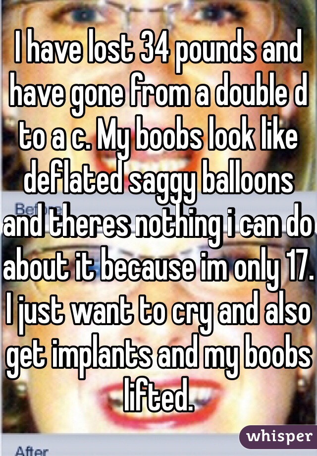 I have lost 34 pounds and have gone from a double d to a c. My boobs look like deflated saggy balloons and theres nothing i can do about it because im only 17. I just want to cry and also get implants and my boobs lifted. 