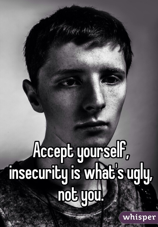 Accept yourself, insecurity is what's ugly, not you. 