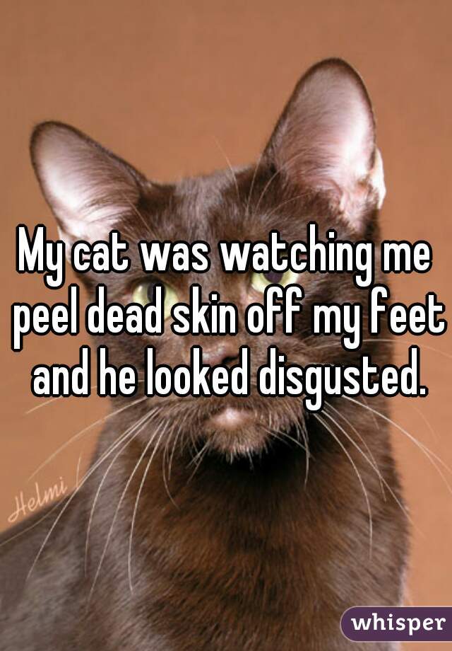 My cat was watching me peel dead skin off my feet and he looked disgusted.